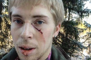 На вратаря шведской команды напал медведь